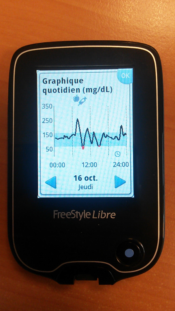 FreeStyle Libre : test et avis du lecteur de glycémie en continu FreeStyle  Libre - Marie Claire