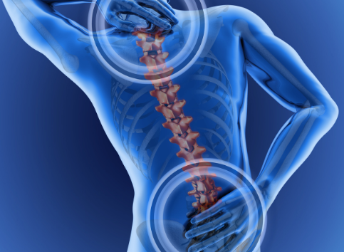 Les traitements des douleurs chroniques : médicaments, TENS, infiltrations et neurostimulation