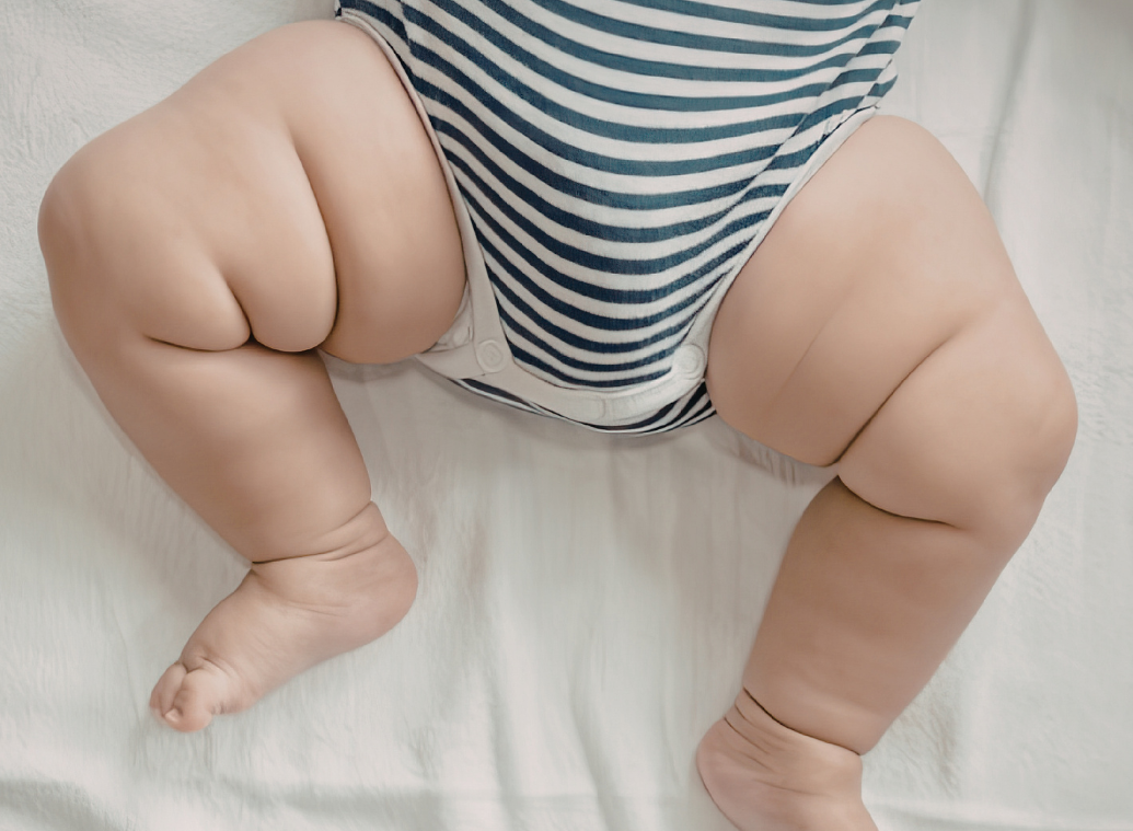 Mon enfant a les jambes arquées : à partir de quand faut-il consulter ?