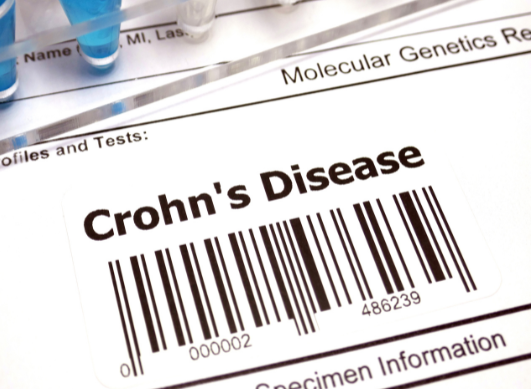 Peut-on faire du sport avec la maladie de Crohn ?