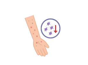Purpura thrombopénique immunologique (PTI) : symptômes, diagnostic et traitements