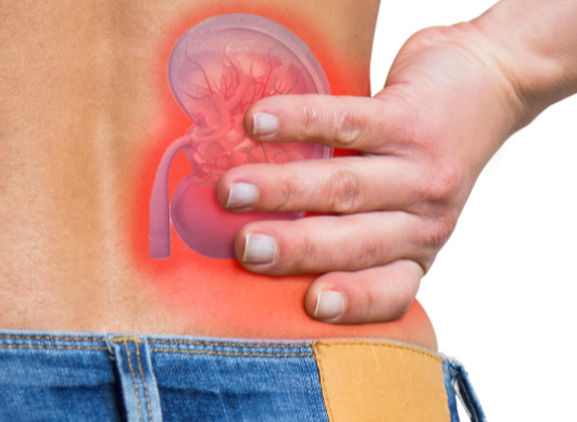 Lupus et reins : comprendre la néphrite lupique