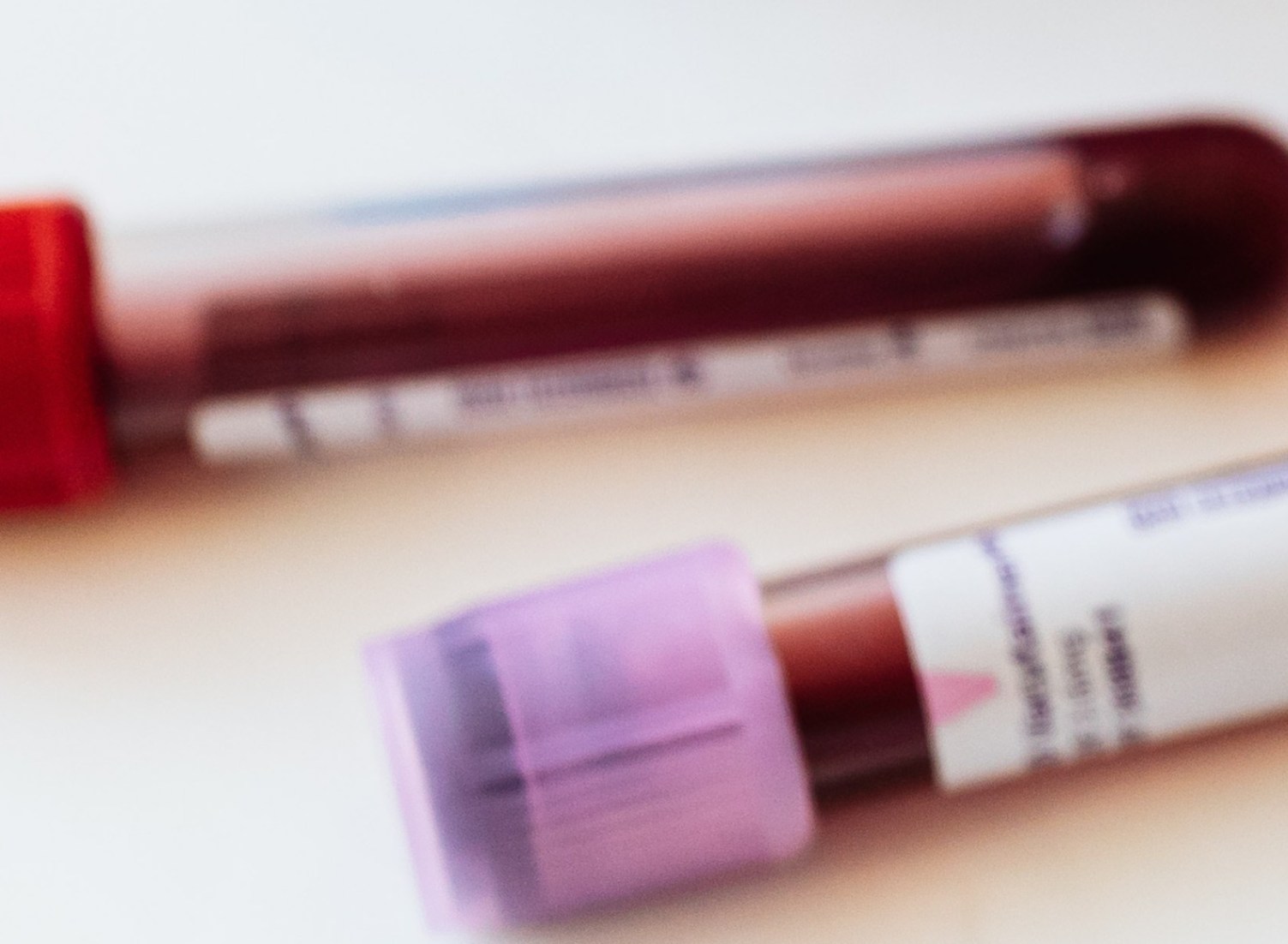 Lupus érythémateux disséminé : comment bien lire ses analyses de sang ?