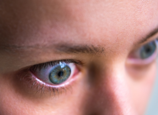 Orbitopathie thyroïdienne : quand le regard devient le reflet de la maladie
