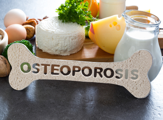 Ostéoporose et alimentation : que manger (et éviter) pour des os plus solides ?
